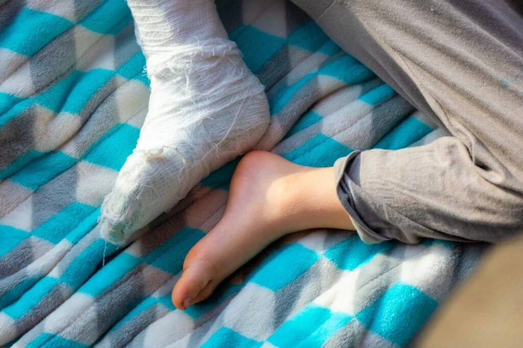 Child with a bandaged foot sitting on a blanket.